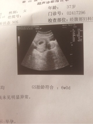 早孕分泌物褐色