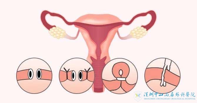 早孕分泌物褐色