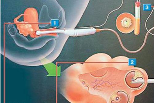 昆明人流手术价钱