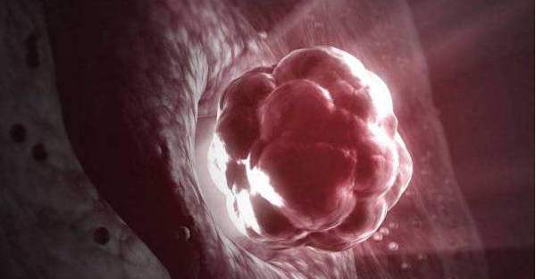 早期茄子型孕囊